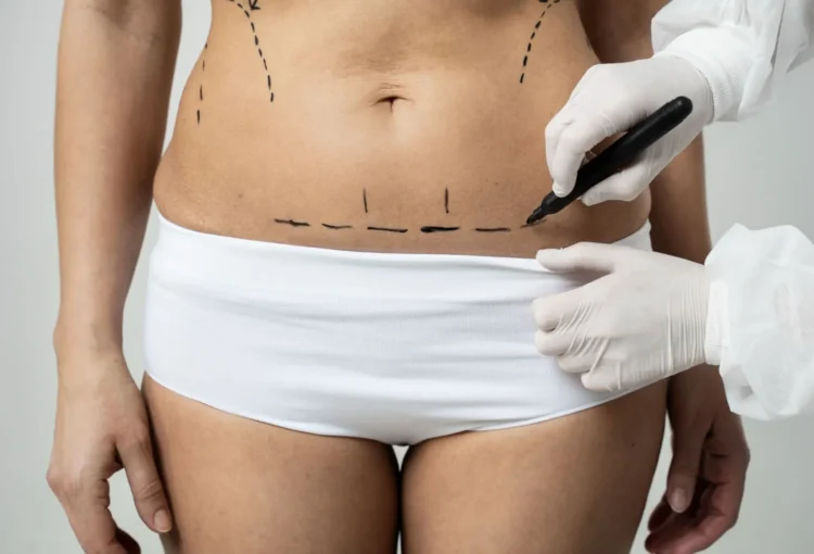 cirurgia-plastica